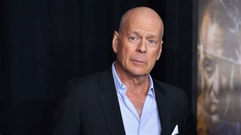 how was bruce willis diagnosed with aphasia